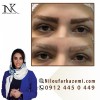 ریموو تاتو ابرو با بروزترین تکنیک های دنیا