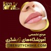 آموزش ریموو تاتو لب با بهترین مدرسان کشور