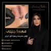 آموزش ریموو تاتو با پشتیبانی آنلاین
