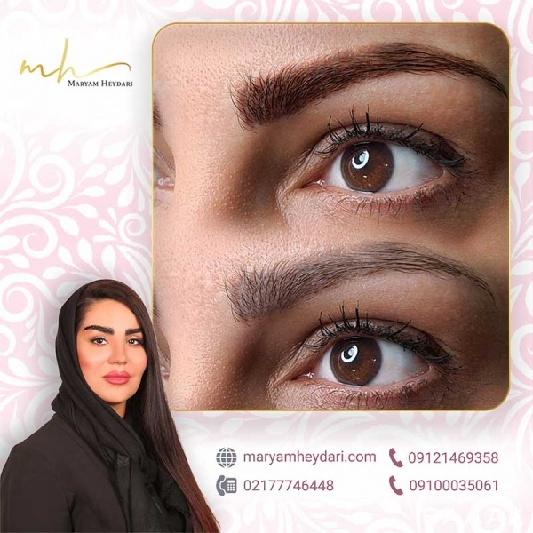 مرکز تخصصی پاک کردن تاتو ابرو مریم حیدری