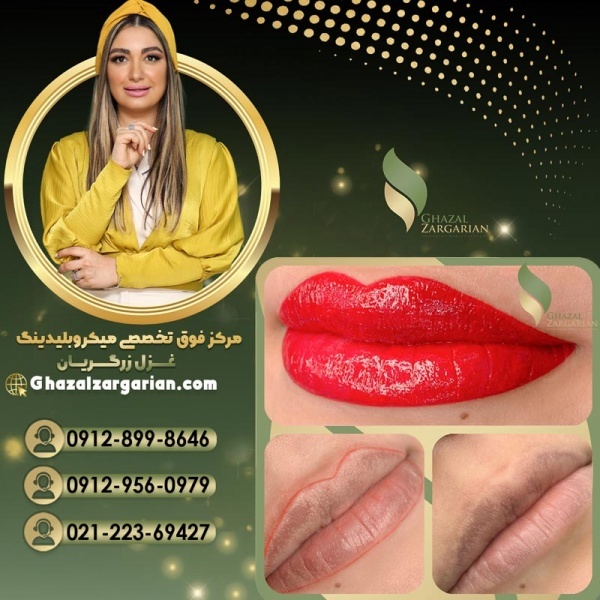 تاتو رژ لب دائم در مرکز غزل زرگریان