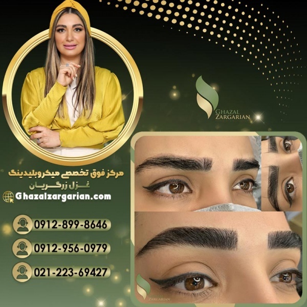 قیمت میکروپیگمنتیشن ابرو با غزل زرگریان