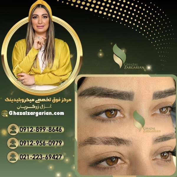 پاک کردن تاتو با مواد با غزل زرگریان