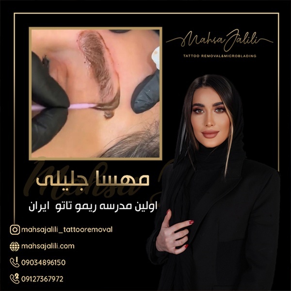 ریموو تاتو ابرو با بهترین کیفیت در شمال تهران