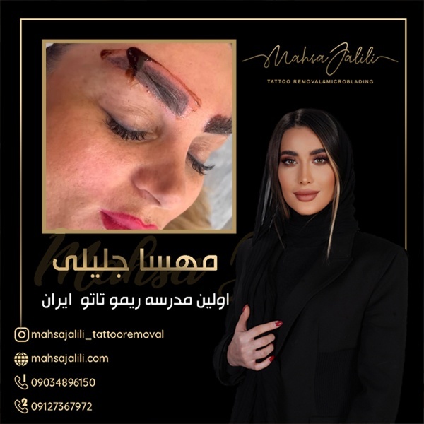 ریموو تاتو ابرو تخصصی با کیفیت استثنایی
