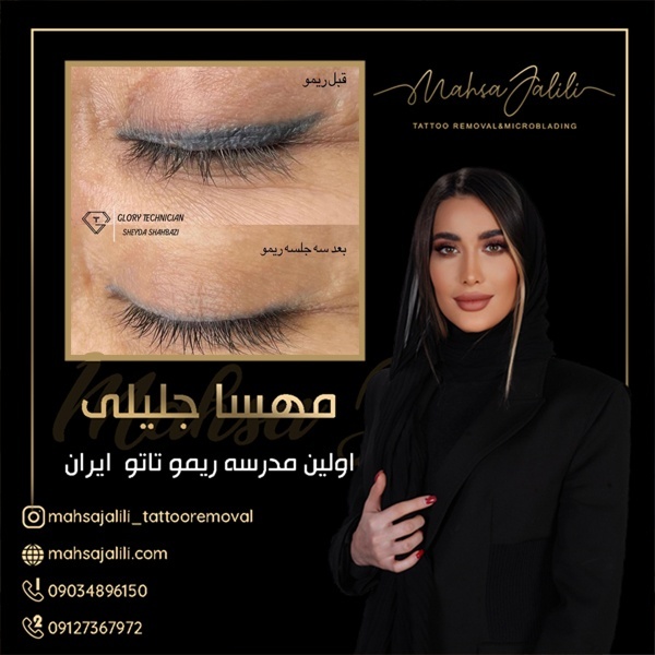 ریمو تاتو خط چشم بدون  ایجاد حساسیت