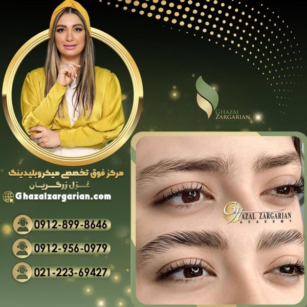 هزینه لیفت ابرو با مواد با غزل زرگریان