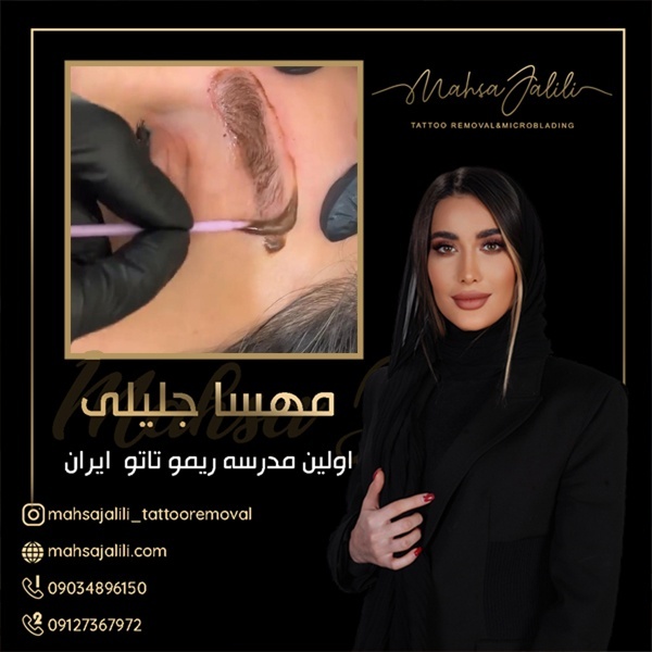 آموزش ریموو تاتو با پشتیبانی آنلاین