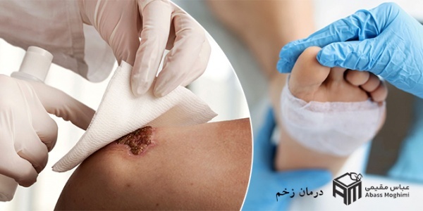 پلاسما تراپی زخم؛ روشی نوین برای درمان زخم و سوختگی