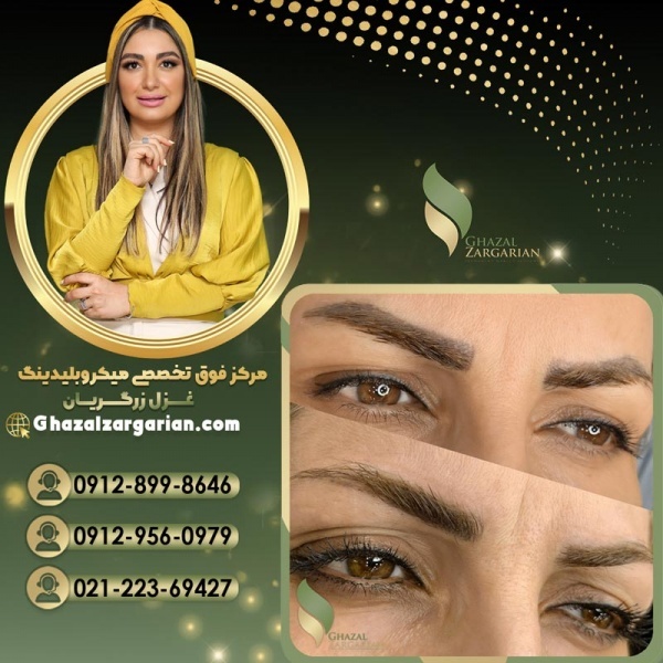 ریموو ابرو با بهترین روشهای غزل زرگریان