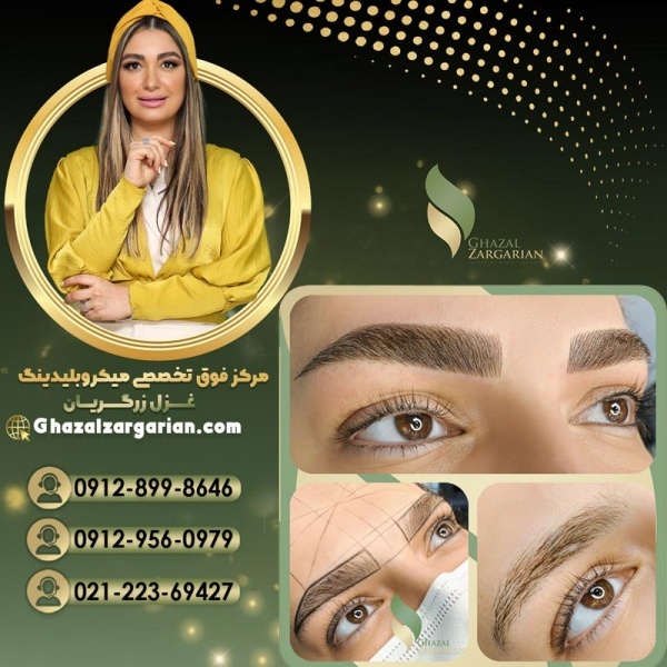 جدیدترین روش فیبروز در مرکز غزل زرگریان