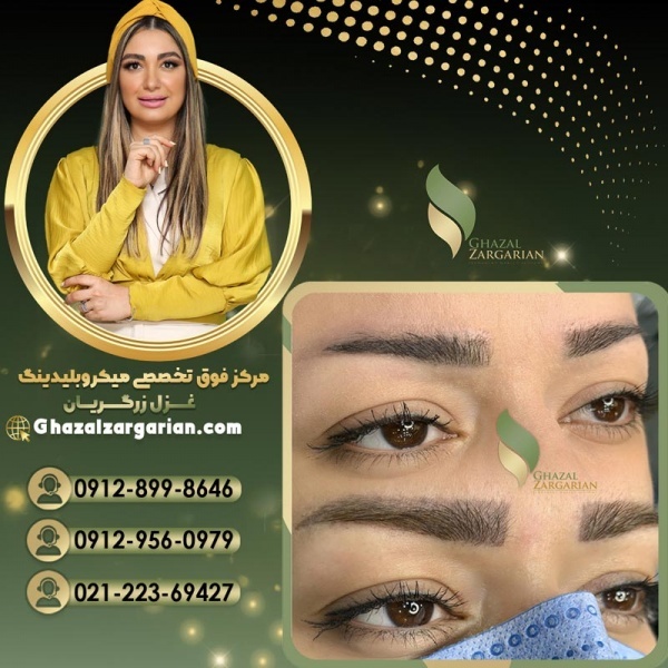 پاک کردن میکروبلیدینگ ابرو با غزل زرگریان تضمینی